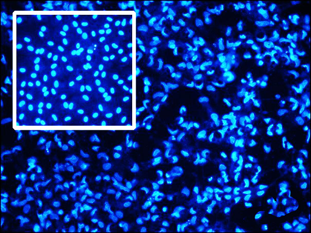 Zum Artikel "Waschmittelenzyme sollen den Karpfen retten"