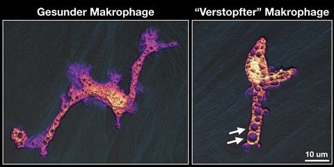 Zum Artikel "Verstopfung in Abwehrzellen löst Entzündung aus"