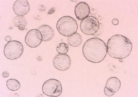Beispielbild von In-Vitro Zysten.