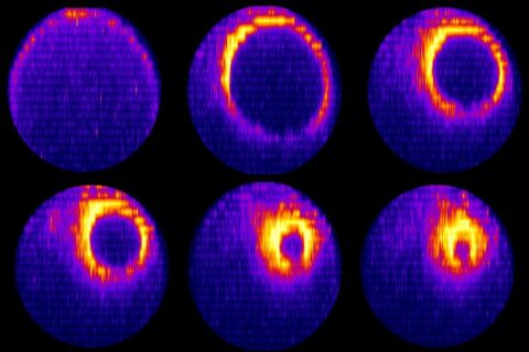 Zum Artikel "Zellforschung: Aus Eins mach Zwei in 20 Minuten"